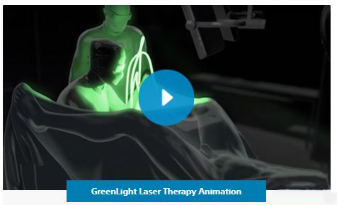 Video-Laser-Verde